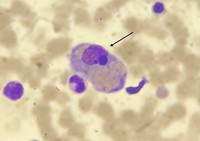 Erythrophagocytosis