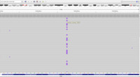 Myeloid sarcoma, NPM1 mutation